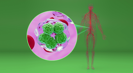 Advancing hematologic malignancy research with integrated multiomic solutions from Signios Bio