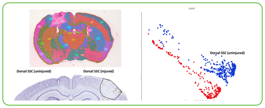 Traumatic Brain Injury model