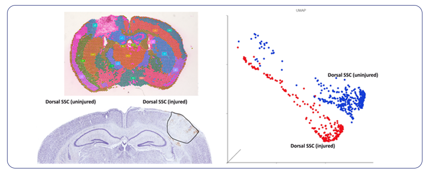 Mapping cellular-landscapes in TBI