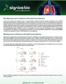 lung-cancer-case-study-thumb Lung cancer case study